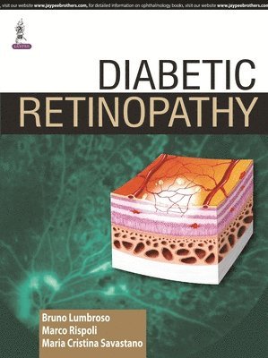 bokomslag Diabetic Retinopathy