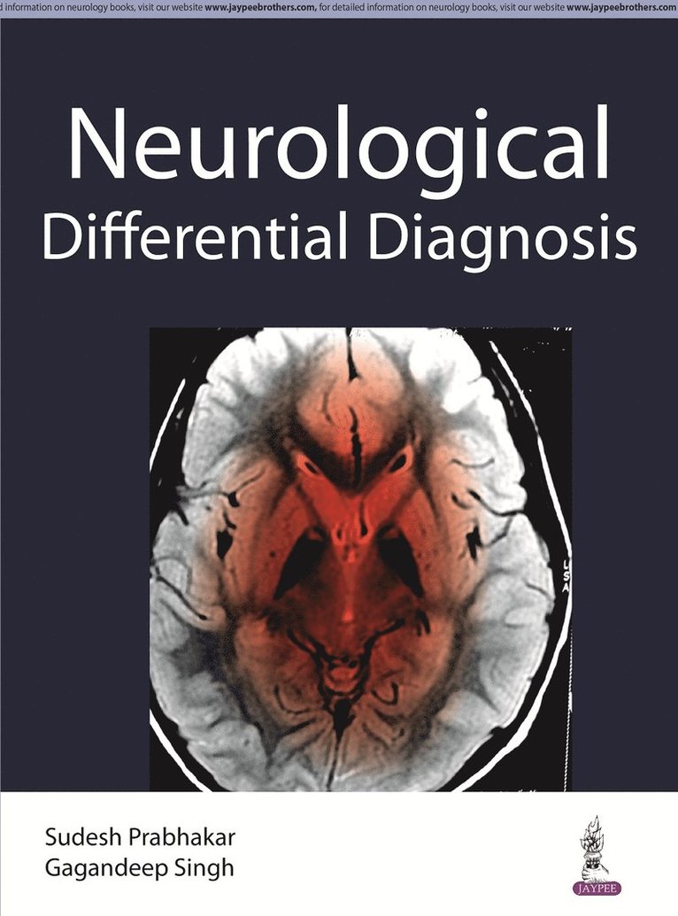 Sudesh Prabhakar, Gagandeep Singh - Differential Diagnosis in Neurology, Häftad