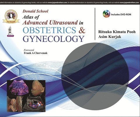 Donald School Atlas of Advanced Ultrasound in Obstetrics and Gynecology 1