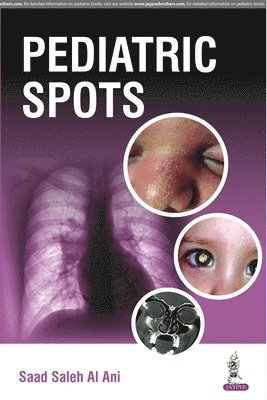 bokomslag Pediatric Spots