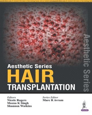 bokomslag Aesthetic Series - Hair Transplantation