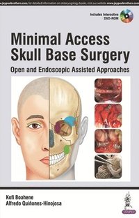 bokomslag Minimal Access Skull Base Surgery