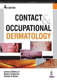 bokomslag Contact & Occupational Dermatology