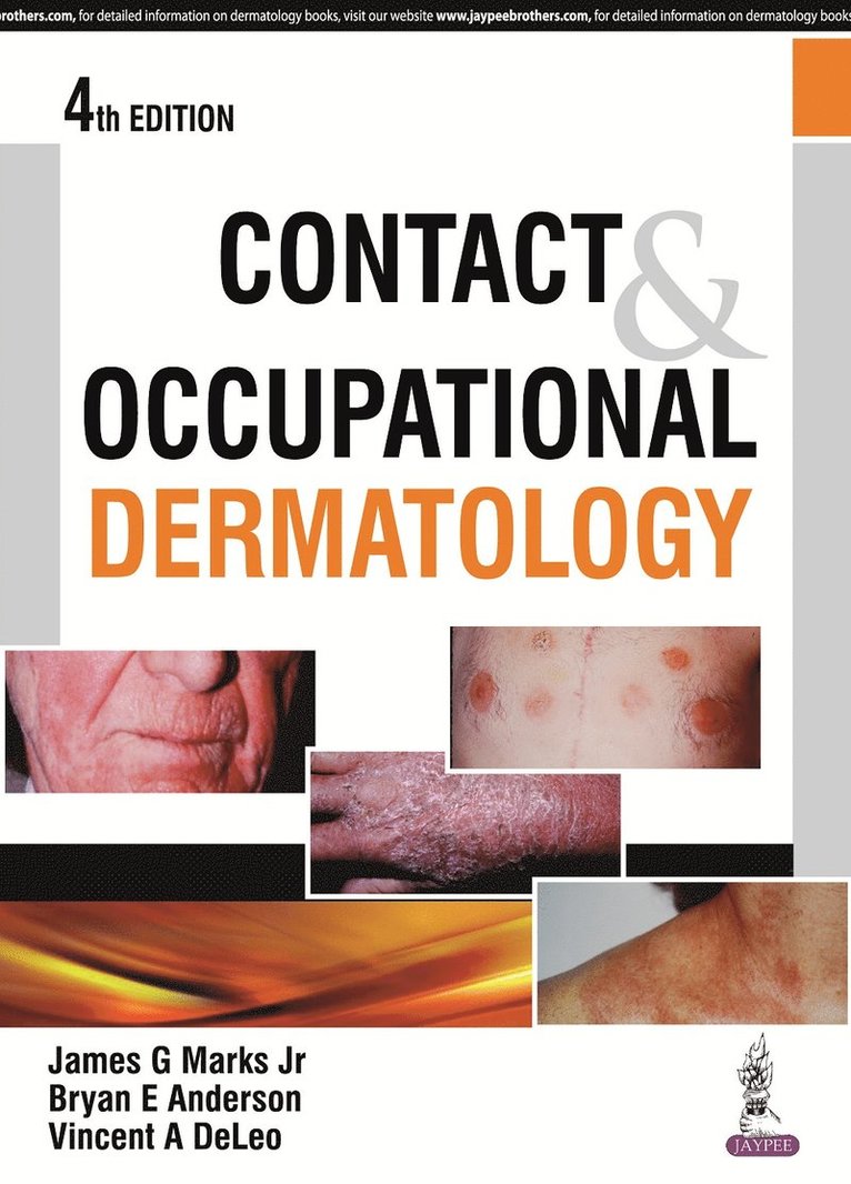 James G Marks Jr, Bryan E Anderson, Vincent A DeLeo - Contact & Occupational Dermatology, Inbunden