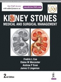 bokomslag Kidney Stones