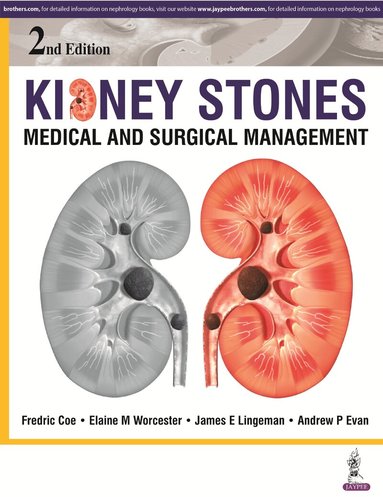 Fredric Coe, Elaine M Worcester, James E Lingeman, Andrew P Evan - Kidney Stones, Inbunden