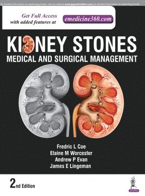 bokomslag Kidney Stones