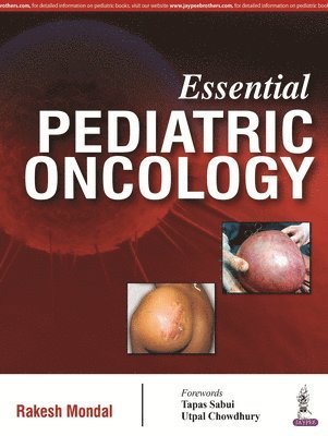 bokomslag Essential Pediatric Oncology