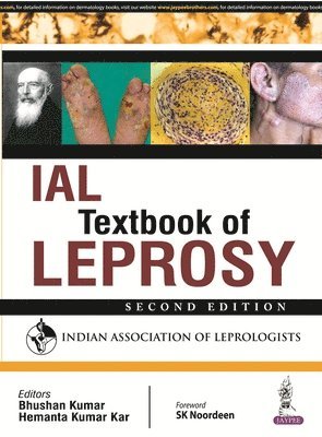 Bhushan Kumar, Hemanta Kumar Kar - IAL Textbook of Leprosy, Inbunden