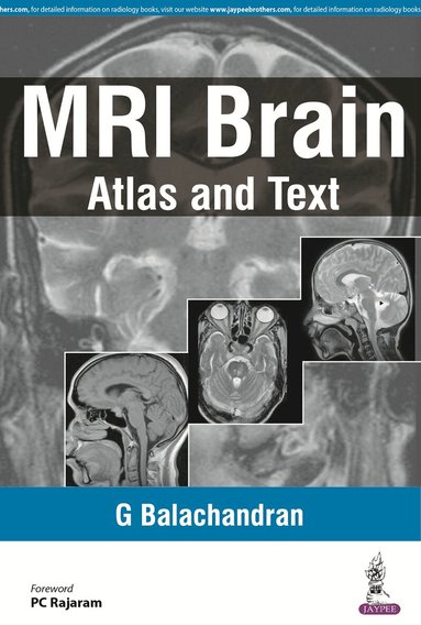 G Balachandran - MRI Brain, Häftad