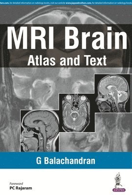 bokomslag MRI Brain