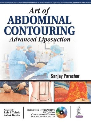 bokomslag Art of Abdominal Contouring