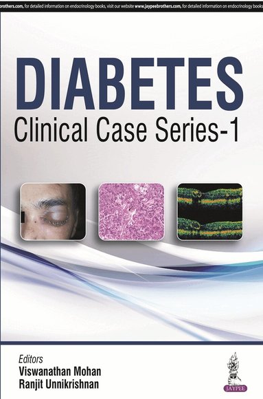 V Mohan, Ranjit Unnikrishnan - Diabetes Clinical Case Series – 1, Häftad
