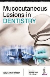 bokomslag Mucocutaneous Lesions in Dentistry