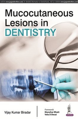 Mucocutaneous Lesions in Dentistry 1