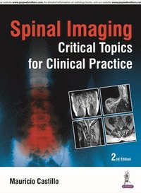 bokomslag Spinal Imaging: Critical Topics for Clinical Practice