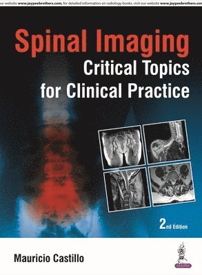 Spinal Imaging: Critical Topics for Clinical Practice 1