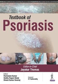 bokomslag Textbook of Psoriasis