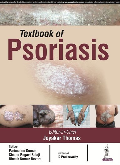 bokomslag Textbook of Psoriasis