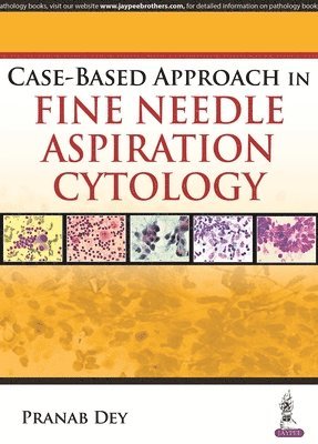 Case-Based Approach in Fine Needle Aspiration Cytology 1
