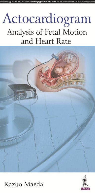 bokomslag Actocardiogram