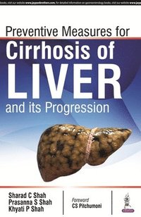bokomslag Prevention Measures for Cirrhosis of Liver and its Progression