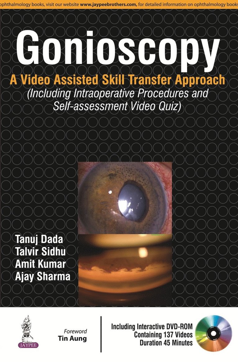 Tanuj Dada, Talvir Sidhu, Amit Kumar, Ajay Sharma - Gonioscopy, Inbunden