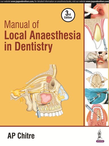 bokomslag Manual of Local Anaesthesia in Dentistry