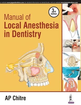 AP Chitre - Manual of Local Anaesthesia in Dentistry, Häftad