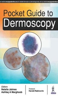 bokomslag Pocket Guide to Dermoscopy