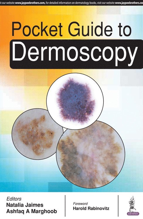 Pocket Guide to Dermoscopy 1