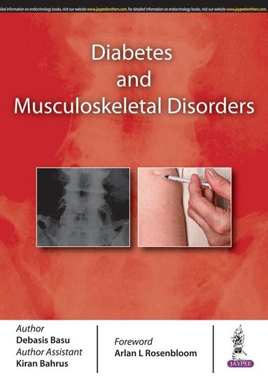 Debasis Basu - Diabetes and Musculoskeletal Disorders, Häftad