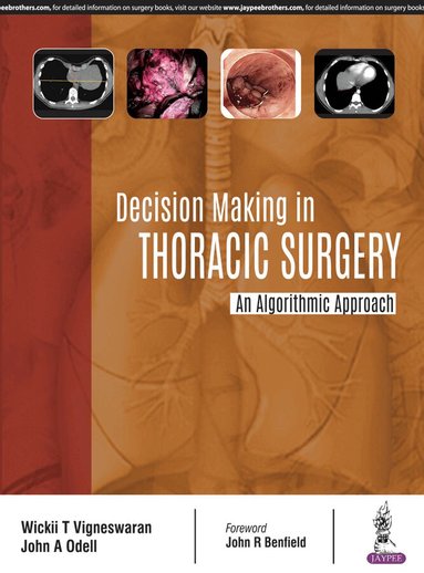 Wickii T Vigneswaran, John Odell - Decision Making in Thoracic Surgery, Häftad