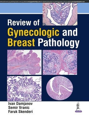 Review of Gynecologic and Breast Pathology 1