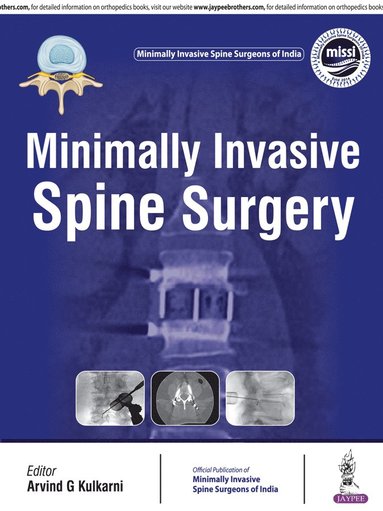 bokomslag Minimally Invasive Spine Surgery