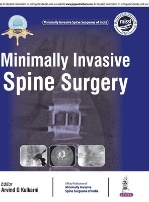 Arvind Kulkarni - Minimally Invasive Spine Surgery, Inbunden