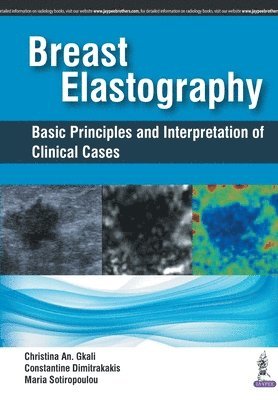 bokomslag Breast Elastography