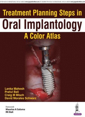 bokomslag Treatment Planning Steps in Oral Implantology