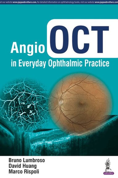 Bruno Lumbroso, David Huang, Marco Rispoli - Angio OCT in Everyday Ophthalmic Practice, Inbunden