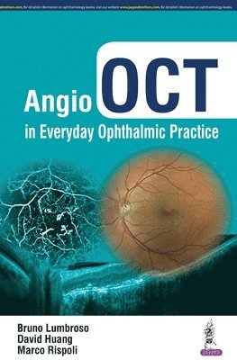 Angio OCT in Everyday Ophthalmic Practice 1