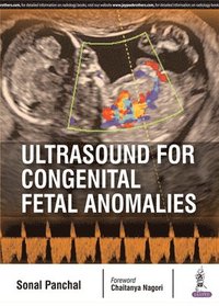 bokomslag Ultrasound for Congenital Fetal Anomalies
