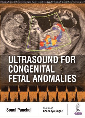 Ultrasound for Congenital Fetal Anomalies 1