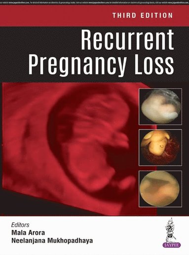 bokomslag Recurrent Pregnancy Loss