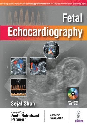 Sejal Shah - Fetal Echocardiography, Häftad