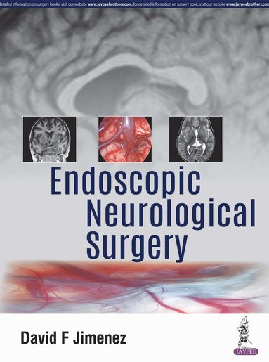 bokomslag Endoscopic Neurological Surgery