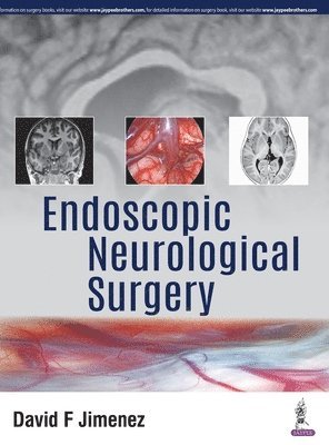 Endoscopic Neurological Surgery 1