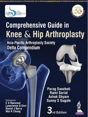 Parag Sancheti, Rami Sorial, Ashok Shyam, Sunny S Gugale - Comprehensive Guide in Knee & Hip Arthroplasty, Inbunden