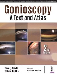 bokomslag Gonioscopy: A Text and Atlas