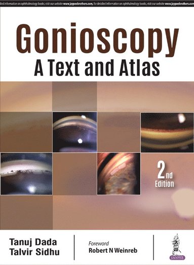 bokomslag Gonioscopy: A Text and Atlas