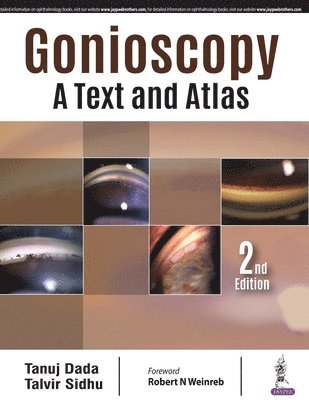 Gonioscopy: A Text and Atlas 1